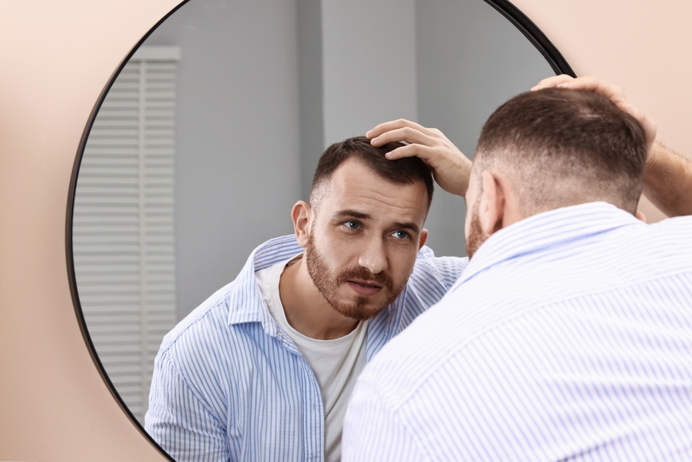 Receding Hairline