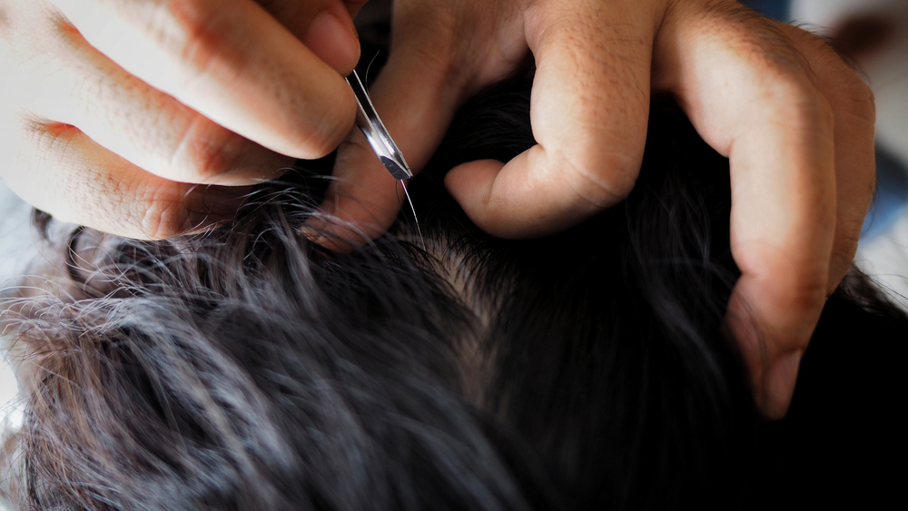 Premature Greying